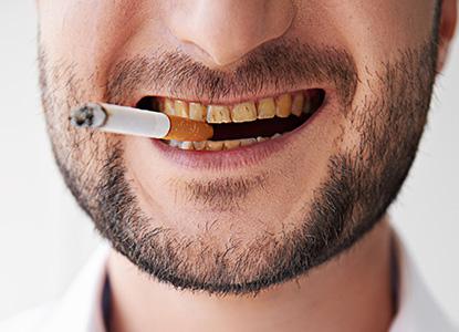 Resultado de imagen de tabaco dientes