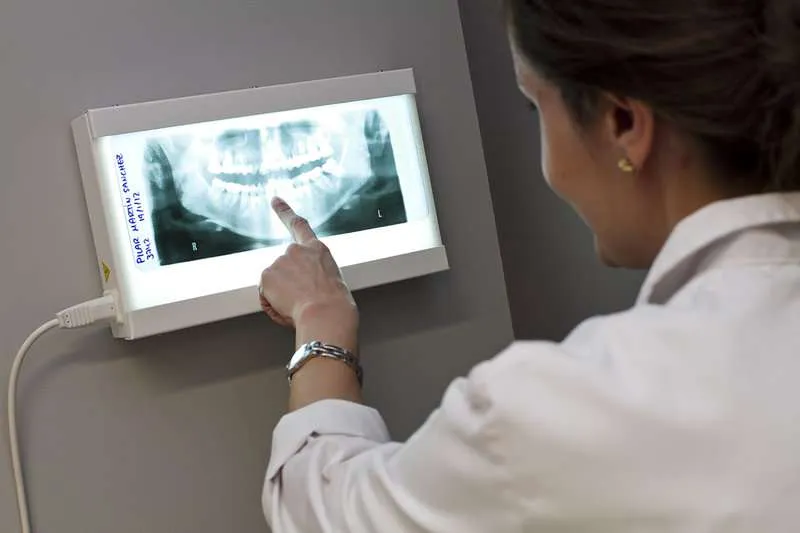 Reposición de dientes perdidos Reposición de dientes perdidos