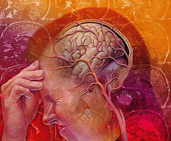 ¿Qué es la neuralgia del trigémino?
