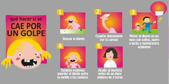 Caída de dientes en niños Caída de dientes en niños