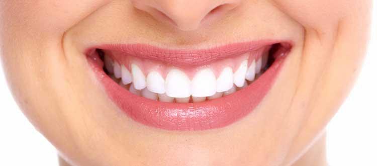 Tipos de diseños de sonrisas