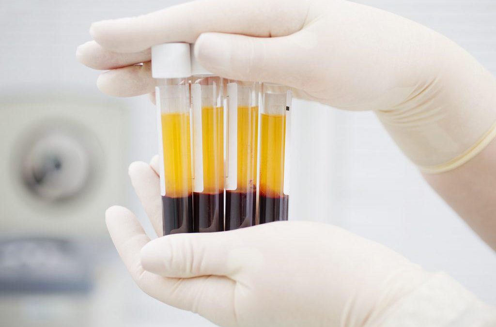 ¿Para qué sirve el plasma rico en fibrina en odontología?