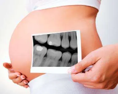 Embarazadas e implantes dentales Embarazadas e implantes dentales