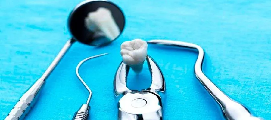 Cuidados después de una extracción dental