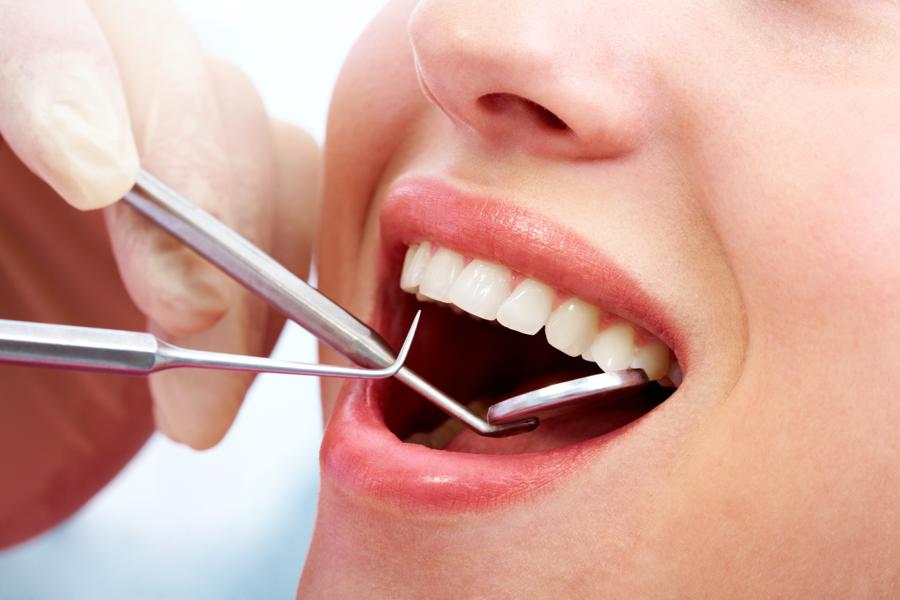 dieta blanca dentisalut blanqueamiento dental
