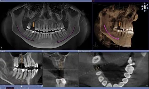 nuevas tecnologias en odontologia nuevas tecnologias en odontologia
