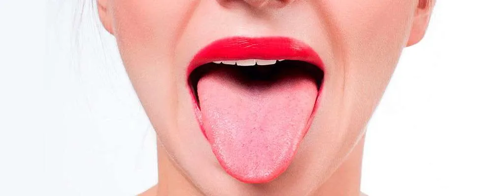 Candidiasis oral: tipos, síntomas y tratamiento
