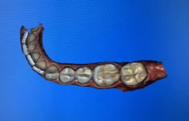 Paso 2 Sistema Cerec Paso 2 Sistema Cerec