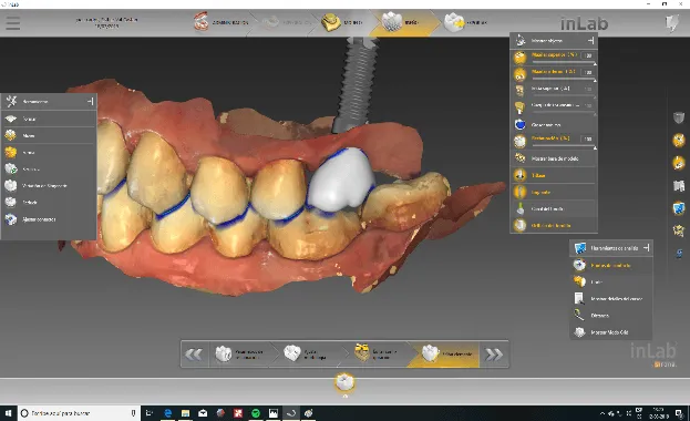 Escáner intraoral de CEREC Escáner intraoral de CEREC