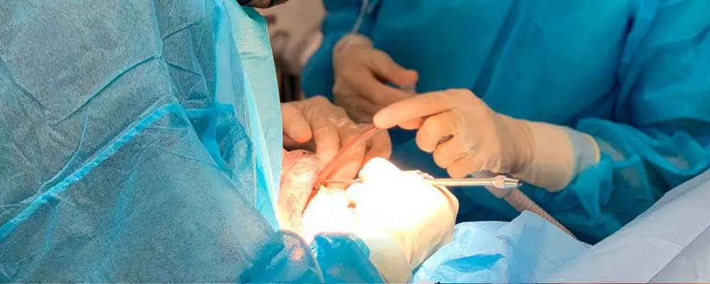 El paciente con problemas de coagulación y sus consideraciones odontológicas