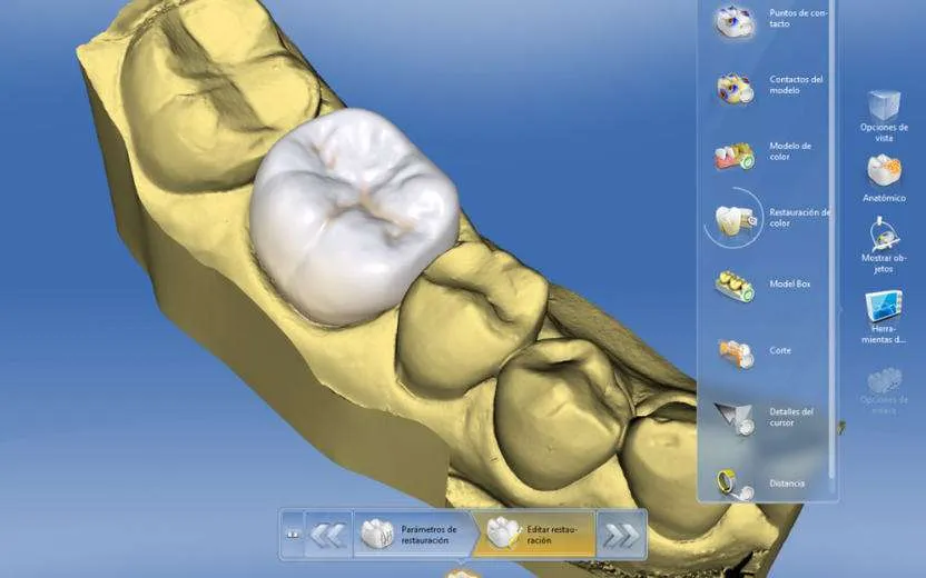 Escáner CAD-CAM Escáner CAD-CAM