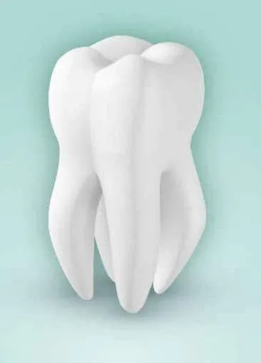 Mono radicular Mono radicular