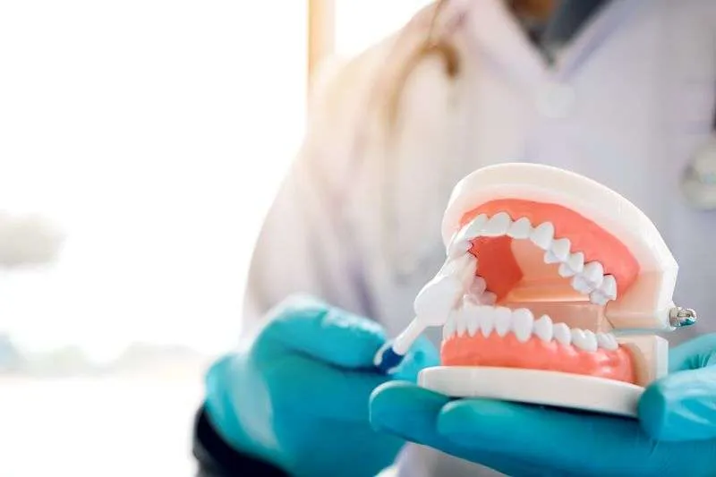 ¿Qué son los implantes dentales? ¿Qué son los implantes dentales?