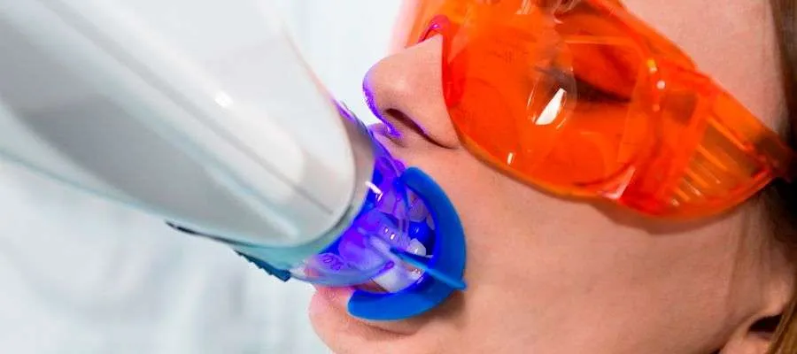 ¿Cuando no se recomienda un blanqueamiento dental?