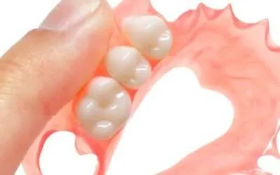 Valplast, prótesis dentales removibles sin ganchos