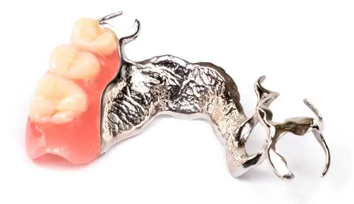 Prótesis dental removible esquelética