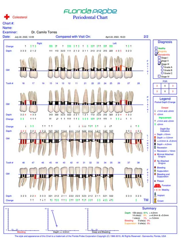 diagnostico-periodoncia2